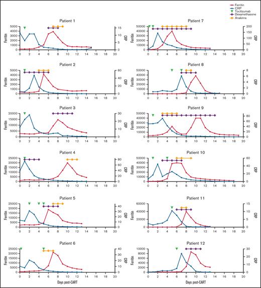 Ferritin, CRP, and treatment over time in patients who developed macrophage activation-like syndrome (MAS-L) following CAR T-cell therapy. Ferritin (red), C-reactive protein (CRP) (blue), and administration of tocilizumab (green triangle), systemic steroids (purple triangle), and/or anakinra (yellow) over time for the 12 patients who developed MAS-L.