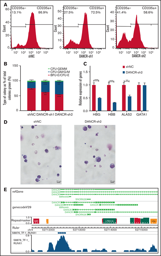 Aberrant expression of DANCR leads to the defects during erythroid differentiation. (A) The detection of CD235a+ cells in differentiated CD34+ cells on day 11 by flow cytometry in green fluorescent protein-positive cells with DANCR-KD. The percentage on the right in each figure represents the proportion of CD235a+ cells. (B) Colony-forming capacity analysis of DANCR knockdown in CD34+ cells. (C) Knockdown of DANCR in CD34+ cells inhibits the accumulation of β-hemoglobin (HBB) and γ-hemoglobin (HBG) proteins and erythroid-specific gene ALAS2 on Day 12. (D) Morphology in differentiated CD34+ cells with DANCR knockdown and control on Day 11 (original magnification ×100; Wright-Giemsa stain) shows vector control (left) and DANCR-KD (right). The size of more differentiated CD34+ cells with DANCR knockdown was larger than that of the control, and the degree of chromatin condensation is reduced. (E) Profile of transcription factor RUNX1 around DANCR in TF-1 cells. Statistical results were analyzed by Student t-test and Kruskal-Wallis test. *P < .05; **P < .01; ***P < .001. Ctrl, control group; KD, knockdown; OE, overexpression.