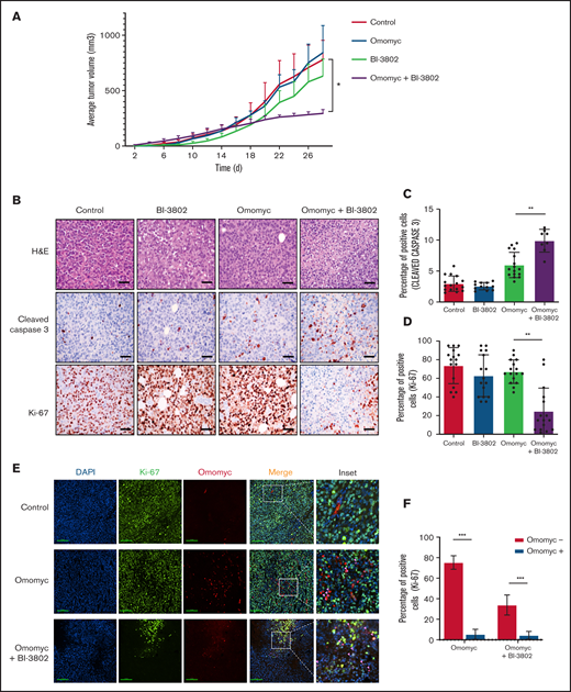 Combined targeting of MYC and BCL6 severely impairs BL growth in mice by reducing proliferation and increasing apoptosis. (A) Growth of tumor xenografts of RAJI cells transduced with doxycycline-inducible Omomyc vector in NSG mice. Lymphoma cells were treated with BI-3802 (5 μM) for 24 hours before injection. Mice were administered normal water (red line) or doxycycline water (blue line) from day 0. Data are mean ± standard error of the mean of 8 tumors per group. *P < .05, paired 2-tailed Student t test. (B) Representative H&E stains (top row) and immunohistochemistry for cleaved caspase 3 (middle row) and Ki-67 (bottom row) performed on RAJI lymphoma arising in NSG mice and treated with the BCL6 degrader BI-3802 together with Omomyc, as in (A) (original magnification ×200). Scale bars, 50 μm. Quantification of cleaved caspase 3+ (C) and Ki-67+ (D) cells in RAJI lymphoma with the indicated treatment. Data were obtained from 4 areas in 4 independent tumors for each treatment. Data are mean ± standard deviation. **P < .01, unpaired 2-tailed Student t test. (E) Representative immunofluorescence performed on RAJI lymphoma grafted in NSG mice and treated with the BCL6 degrader BI-3802 together with Omomyc, as in (A). Cells were stained for Ki-67 (green), Omomyc (red), and DAPI (blue) for the nucleus (original magnification, ×200). Scale bars, 100 μm. Higher-magnification images of the white boxes are shown in the far right panels. Pink arrow-heads in inset images indicate Ki-67−/Omomyc+ nuclei. (F) Quantification of the experiment described in (E). Three sections for each treatment were used to score the number of Ki-67+/Omomyc− and Ki-67+/Omomyc+ nuclei. ***P < .001.