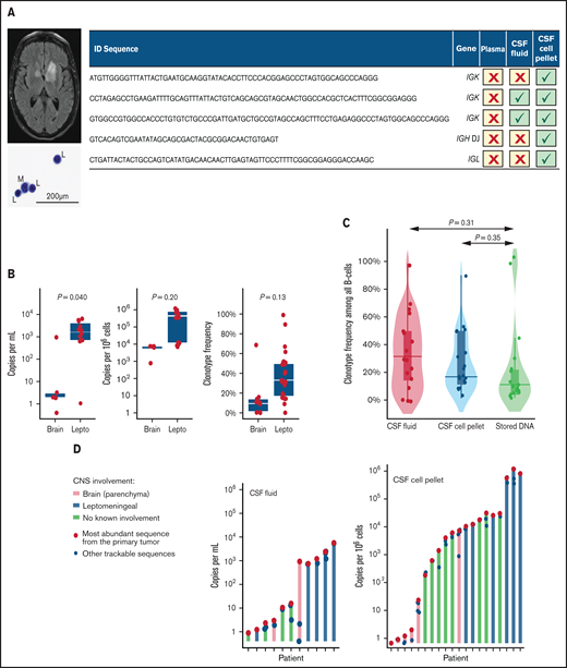 CSF NGS-MRD assay for diagnosis of CNS involvement in lymphoma. (A) Case study of a primary CNS lymphoma, showing a magnetic resonance imaging gadolinium-enhanced T2 turbo spin echo sequence with intraparenchymal tumors; a standard CSF cytospin stained with Papanicolaou stain showing scant lymphocytes (L) and monocytes (M) (original magnification, ×600; cell count was 0 per cubic millimeter, and flow cytometry showed an insufficient number of events for evaluation); and clonotypic DNA sequences examined in the primary tumor, plasma (where no sequences were detectable), CSF acellular fluid, and CSF cell pellet fraction. (B) Clonotypic DNA sequences in the CSF of patients with parenchymal brain (n = 2) and leptomeningeal (Lepto, n = 5) lymphoma, measured as copy number per milliliter of acellular fluid, per 106 diploid genomes in the cell pellet fraction, and as the clonotype frequency (in both types of samples). Bars show medians and interquartile ranges; P-values are from Somers’ D statistic adjusted for intrapatient clustering. Note the logarithmic scale on the left and middle panels. (C) distribution of clonotype frequency in CSF fractions obtained from patients with known CNS lymphoma: acellular fluid, cell pellet, and stored historical DNA. (D) relative abundance of various clonotypic sequences in the CSF of each patient (data from all patients included in the study who had a positive NGS-MRD assay in the CSF). The bars and red circles indicate the amount of the most abundant sequence from the primary tumor (expressed as copy count per milliliter of CSF acellular fluid or per 106 diploid genomes in the CSF cell pellet); the blue circles indicate other clonotypic sequences in the sample.