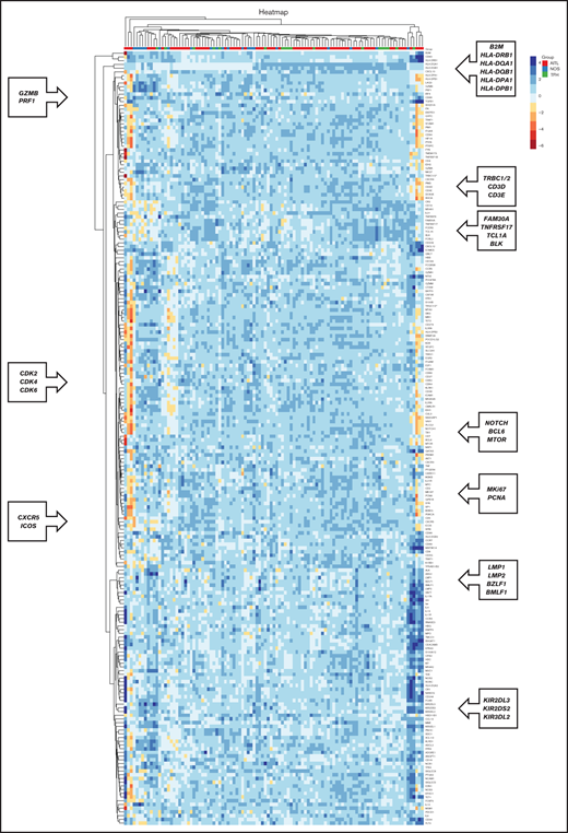 Co-regulated genes, as classified by unsupervised hierarchical clustering analysis, based on the genes included in the NanoString platform. Heatmap depicting gene clusters of coregulated genes that allow the recognition of signatures expressed by tumoral and stromal cells. Each column represents sample categories (AITL in red, PTCL-NOS in blue, and PTCL-TFH in green). Each row represents the expression level of a gene, depicted according to the color scale shown.