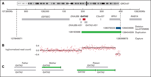 Region of chromosome 3 showing copy number variation in the patient. (A) The captured region (3:127849971-128398873) is indicated by dashed lines, the duplication detected (3:128190688-128404309) is shown in green, and the deletion (3:128379023-128303996) is shown in blue. (B) The normalized read count mapping to the captured region. (C) The predicted arrangement of alleles in the parents and patient. The asterisk (*) indicates the position of GATA2, and the broken line denotes the site of the deletion.