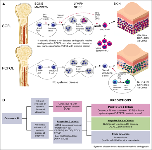 Models of pathogenesis for SCFL and PCFCL and proposed clinical prediction algorithm. (A) Proposed SCFL and PCFCL ontogenies. Solid red arrows denote sites of genetic mutational events supported by the FL literature, and dotted red arrows denote hypothesized sites. CMG, chromatin-modifying genes. (B) Proposed clinical prediction algorithm for approaching newly diagnosed cases of cutaneous follicular lymphoma.