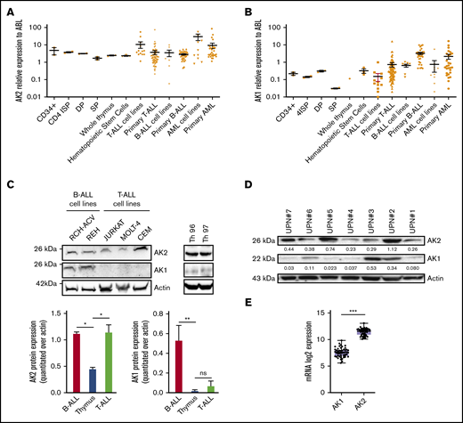 AK2 isoform exhibit robust expression in T-ALL. (A-B) Transcriptional expression of AK2 (A) and AK1 (B) in thymic subpopulations, total thymus, T-ALL, B-cell ALL (B-ALL), and acute myeloid leukemia (AML) primary cells and lines. Mean ± standard deviation are represented. (C-D) Western blot showing AK2 and AK1 expression in T-ALL cell lines (JURKAT, MOLT4, and CEM), B-ALL cell lines (REH and RCH-ACV), and total thymus (Th96 and Th97) (C) andprimary cells from T-ALL samples (UPN#1-UPN#7) (D). The AK2/actin or AK1/actin ratios are represented under each band. (E) AK1 and AK2 transcriptional expression assessed by RNA sequencing in 47 T-ALL primary samples. *P < .05; **P < .01; ***P < .001. 4ISP, CD4-immature single positive; DP, double positive; ns, not significant; SP, simple positive.