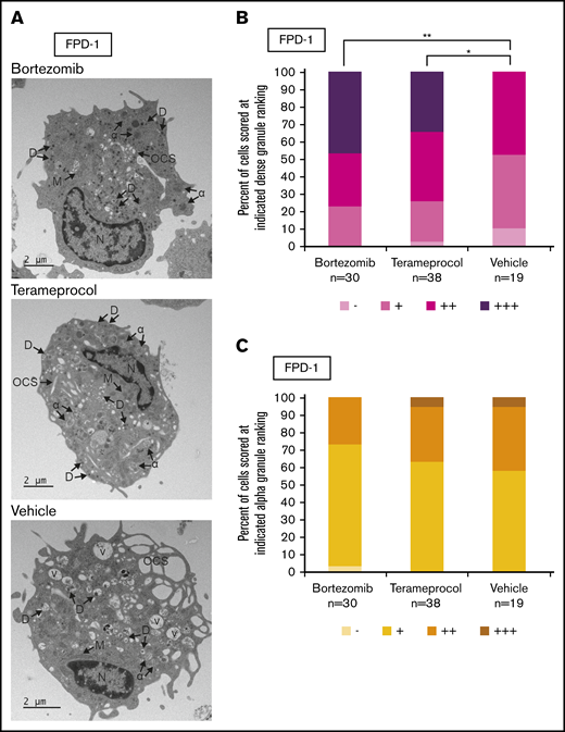 Effect of RUNX1 degradation inhibitor treatment on platelet granule formation during in vitro megakaryocyte differentiation of primary RUNX1-FPD bone marrow MNCs. Primary cells from a patient with RUNX1-FPD were treated and harvested as shown in Figure 5A. (A) Thin-section TEM images of cells treated with bortezomib, terameprocol, or vehicle. Arrows indicate ultrastructural components: dense granules (D), α-granules (α), open canalicular system (OCS), nucleus (N), mitochondria (M), and vacuoles (V). (B) Proportion of cells scored at given ranking for presence of dense granules. (C) Proportion of cells scored at given ranking for presence of α-granules. Rankings were designated as the following number of granules per cell: −, 0; +, 1 to 10; ++, 10 to 20; +++, >20. Unidentifiable granules were not included in the ranking. *P < .025; **P < .01, using a Bonferroni-adjusted χ2 test of independence.