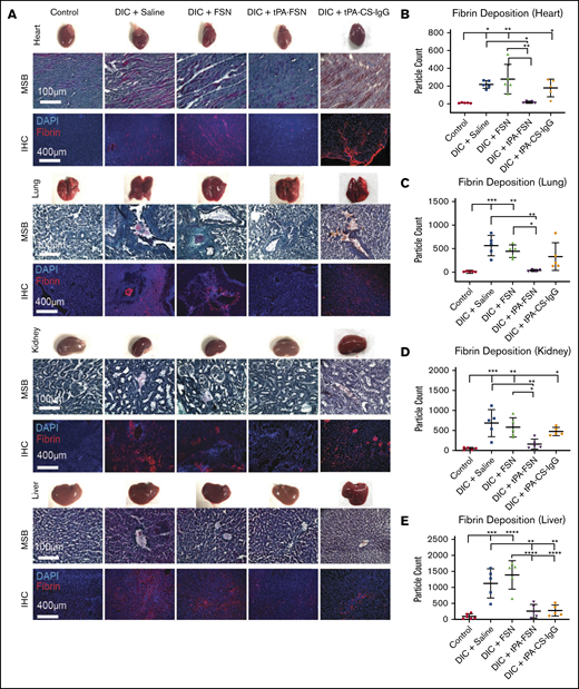 In vivo microthrombi examination in a DIC rodent model. (A) Shown are LPS-induced DIC rodent model harvested organs, including heart, lungs, kidneys, and liver, with corresponding photos of whole organs, MSB-stained tissue sections, and IHC for fibrin deposition in tissue sections. (B-E) DIC animals were treated with saline (n = 5), unloaded FSNs (n = 5), tPA-FSNs (n = 5), and tPA-CS-IgG (n = 5) and compared with controls (n = 6). Images were taken on an EVOS FL Auto Imaging System at 10× magnification. Corresponding quantification (performed with ImageJ particle analysis software) for IHC of fibrin deposition in heart (B), lung (C), kidney (D), and liver (E) tissue sections was averaged using 3 images per section for each animal (n = 6 for control liver, n = 4 for DIC + tPA-FSN lung, and n = 5 for all other groups). Data are presented as average ± standard deviation. Data sets were analyzed via 1-way ANOVA with a Tukey’s post hoc test using a 95% confidence interval. DAPI, 4′,6-diamidino-2-phenylindole. *P < .05; **P < .01; ***P < .001; ****P < .0001.