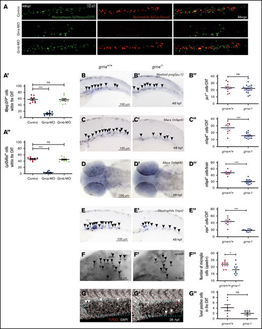 Absence of grna leads to decreased myeloid differentiation during embryo development. (A) Representative fluorescence images, and quantification by fluorescence microscopy (A′,A″) of the tails of 48 hpf Mpeg1:eGFP; Lyz:DsRed double transgenic embryos injected with Grna mismatch control, Grna, or Grnb MOs. (B,B′-F,F′) WISH for the myeloid progenitor (pu.1), macrophage (mfap4), neutrophilic (mpx), and microglia (apoeb) markers in grna−/− and grna+/+ control embryos at 48 hpf (B,B″-E,E″) or 5 days post fertilization (dpf) (F-F″). Black arrowheads depict cells expressing the indicated transcripts. (B″,C″,D″,E″,F″) Enumeration of apoeb, pu1+, mfap4+, and mpx+–expressing cells shown in (B-F and B′-F′). Each dot represents the number of positive cells in the photographed area in each embryo. Bars represent mean ± SEM. *P < .05; ***P < .001. (D) Magnification ×10. (G,G′) Maximum projections of the CHT (dotted blue region) of 36 hpf (G) grna+/+ or (G’) grna−/− embryos assayed for TUNEL (red) and 4′,6-diamidino-2-phenylindole (DAPI) (white nuclei). White arrowheads denote apoptotic nuclei. (G″) Enumeration of apoptotic cells in the CHT are quantified in panel G″. Horizontal lines indicate mean ± SEM. ***P < .001. ns, not significant.