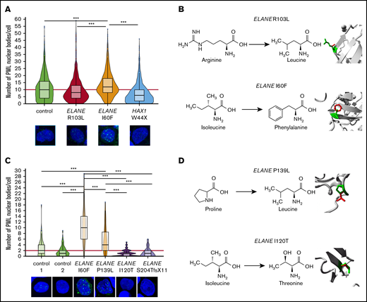 Increased numbers of PML-NBs in ELANE-SCN HPCs with predicted NE-misfolding mutations. (A) Quantifications of the number of PML-NBs per cell, by immunofluorescence stainings, shows increased numbers of PML-NBs in ELANE-I60F derived HPCs (data are pooled from 2 independent clones, 5 independent experiments, and 2 different stainings resulting in control, n = 1119; ELANE-R103L, n = 720; ELANE-I60F, n = 732; HAX1-W44X, n = 914, where n = the number of cells). The red line indicates the median number of PML-NBs/cell for the control HPCs. (B) Amino acid alterations of the ELANE-R103L and ELANE-I60F mutations, with a closeup of the mutation in ribbon-presentation. The wild-type amino acid is depicted in green and the mutant in red. (C) Quantifications of the number of PML-NBs in CD34+ bone marrow cells, showing increased numbers of PML-NBs in ELANE-mutant HPCs with predicted NE misfolding (I60F and P139L). The red line indicates the median number of PML-NBs/cell for the control HPCs. Cells analyzed: control 1, n = 89; control 2, n = 127; ELANE-I60F, n = 79; ELANE-P139L, n = 63; ELANE-I120T, n = 103; and ELANE-S204TfsX11 n = 74. (D) Amino acid alterations of the ELANE-P139L and ELANE-I120T mutations, depicted as outlined under panel B. ***P < .001.