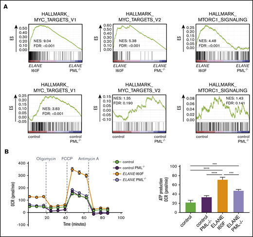PML activates metabolic pathways in ELANE-I60F HPCs. (A) GSEA comparing PML proficient and deficient cells showing that PML induces MYC and mTORC1 signaling in ELANE-I60F, but not in control HPCs. Data are derived from 3 independent experiments. (B) Oxygen consumption rate (OCR) measured with the Seahorse mitochondrial stress test (Agilent) showing PML-dependent increases in basal respiration, ATP, and maximum respiration in ELANE-I60F cells (n = 5). FDR, false discovery rate; NES, normalized enrichment score. ***P < .001, ****P < .0001.