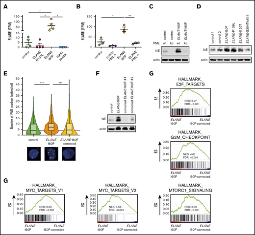 PML induces expression of ELANE-I60F. (A-B) Expression of ELANE in TPM showing upregulated expression in ELANE-I60F, but not ELANE-R103L and HAX1-W44X (data are derived from 2 independent clones and 2 independent experiments) (A), and increased levels of ELANE messenger RNA in ELANE-I60F HPCs, which is reduced to control levels when PML is absent (n = 3 independent experiments) (B). (C) Immunoblot showing PML-dependent NE protein abundance, with increased levels in ELANE-I60F cells. (D) Immunoblot of patient BM cells showing increased NE protein abundance in ELANE-mutant cells with predicted NE misfolding (I60F and P139L), but not others (I120T and S204TfsX11). (E) Quantification of immunofluorescence images showing increased, ELANE-I60F–driven numbers of PML-NBs. Data are pooled from 3 independent experiments and 3 independent ELANE-I60F–corrected clones resulting in; control: n = 126; ELANE-I60F: n = 144; ELANE-I60F corrected n = 442, where n = the number of cells. The red line indicates the median number of PML-NBs/cell for the control HPCs. (F) Immunoblot showing increased NE protein abundance in ELANE-I60F cells, which is reduced to control levels upon correction of the mutation, as shown in 2 independent clones. (G) GSEA comparing ELANE-I60F HPCs with corrected ELANE-I60F HPCs (2 independent experiments and 3 independent corrected clones) showing increased MYC, mTORC1, and cell cycle–related signatures in ELANE-I60F HPCs. ELANE PML−/−, ELANE-I60F PML−/−. *P < .05, **P < .01, ***P < .001.