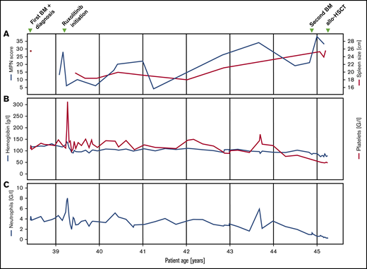 Clinical and laboratory parameters. Longitudinal follow-up of myeloproliferative neoplasm total symptom score, spleen size (A), hemoglobin, platelet (B), and neutrophil count (C).
