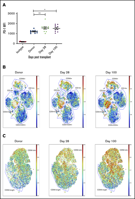 PD-1 is upregulated on NK cells in transplant recipients by day 28 posttransplant compared with donor NK cells and impairs NK cell function against PD-L1–expressing tumor targets. (A) NK cells from 10 sibling-matched donors and recipients 28 days posttransplant were stained for PD-1 expression. (B-C) PBMCs from the same 10 donors and recipients were analyzed by CyTOF up to day 100 posttransplant and visualized by bulk lymphocyte subsets (B) or focused specifically on NK cells (C) (n = 10). Horizontal bars indicate the mean ± SEM. *P < .05; **P < .01. MFI, mean fluorescence intensity.