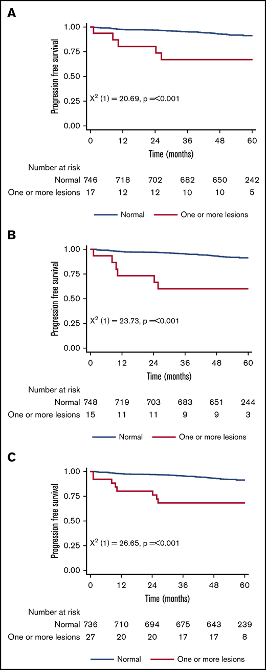 Patient PFS. Stratified by presence/absence of original major route ACAs (A), additional lesions (B), and combined 9 lesions (C).