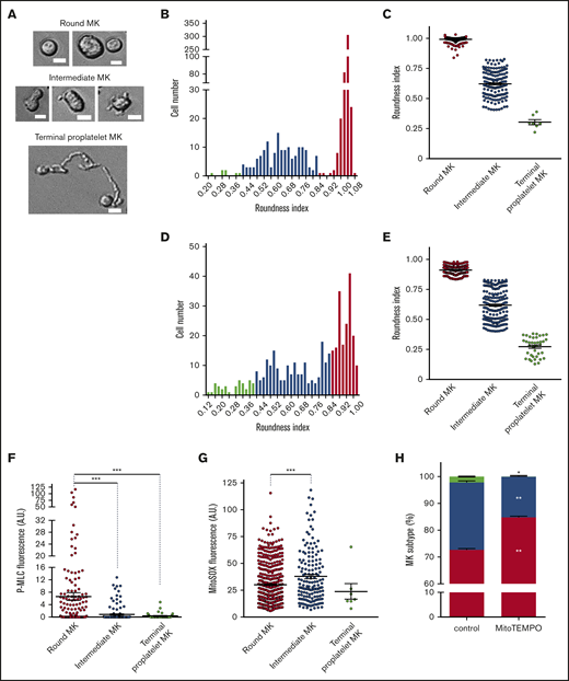 Intermediate MKs exhibit high levels of mitochondrial superoxide anion. Mature MKs were collected after the BSA gradient and incubated for 5 (A-C; F-H) or 24 (D-E) hours before morphometric analysis by phase-contrast microscopy and Image J software and/or fluorescence analysis of individual cells after P-MLCSer19 or MitoSOX labeling. (A-E) Phase-contrast microscopy analysis differentiated 3 states of thrombopoiesis based on morphological parameters. (A) Representative images illustrate round, intermediate, and terminal MKs. Bars represent 10 µm. (B-E) The roundness index of the individual MKs was scored according to the equation (4π × area)/perimeter2 at 5 (B-C) and 24 (D-E) hours. The number of cells was recorded according to the roundness index (B,D). The binning analysis (C,E) categorized the MKs into round (red), intermediate (blue), and terminal proplatelet (green) MKs, according to thresholds set at 0.40 and 0.83; dot plots show individual data and median lines (n = 3, Mann-Whitney U test). (F) Phospho-Ser19-MYL9 (P-MLC) fluorescence was measured in individual cells from the 3 populations of MKs by fluorescence microscopy and expressed as AUs normalized to the whole cell surface. Dot plots show individual data and median lines (n = 3, Mann-Whitney U test). ***P < .001. (G) MitoSOX fluorescence was measured in individual cells from the 3 populations of MKs and expressed as AUs normalized to the cell surface (n = 3; Mann-Whitney U test). *P < .05; ***P < .001. (H) Distribution of the 3 indicated populations of MKs after MitoTEMPO (10 µM) treatment; data are expressed relative to total cells (means ± SEM; n = 3; treated vs control cells ratio paired Student t test). *P < .05; **P < .01.