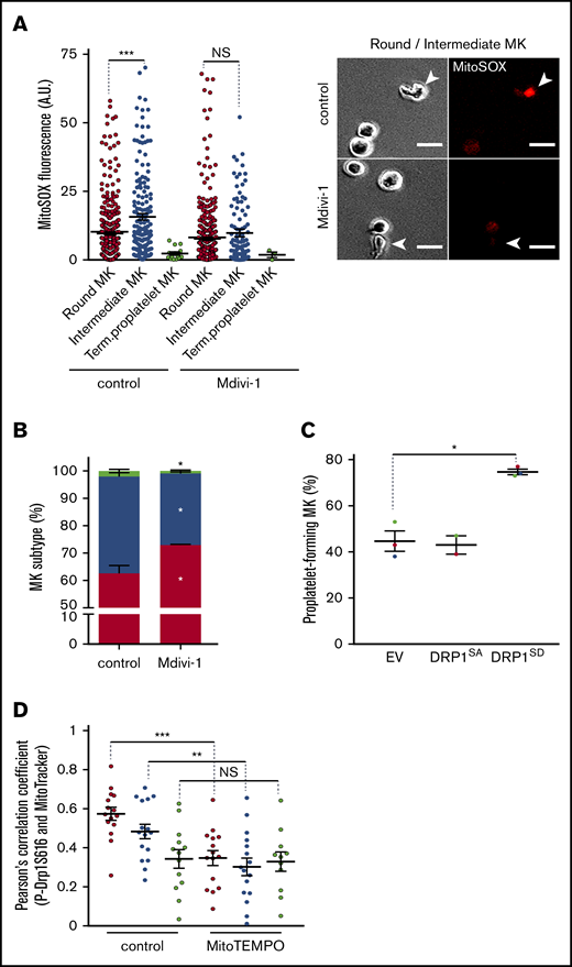 Coupling of mitochondrial dynamics and mtROS levels during formation of proplatelets. Mature MKs were treated for 5 hours with the indicated drug (Mdivi-1, 10 µM; NAC, 1 mg/mL; MitoTEMPO, 10 µM) or dimethyl sulfoxide solvent as the control, and processed for fluorescence microscopy (A), phase-contrast microscopy (B-C), and fluorescence confocal microscopy (D). (A) Mean MitoSOX fluorescence intensity (left) of individual round (red dot), intermediate (blue dot), and terminal (green dot) MKs upon treatment with Mdivi-1. Dot plots show individual data and median lines (n = 3, control vs Mdivi-1; Mann-Whitney U test; ***P < .001). Representative images (right), as indicated (arrowheads: intermediate MKs). Bar represents 10 µm. (B) Distribution of the indicated MK subtypes, expressed relative to total cells observed. (Means ± SEM; n = 3; ratio paired Student t test for drug-treated vs solvent-treated MKs). *P < .05. (C) Transduced CD34+-derived, mature MKs with the indicated lentiviral particles were treated with doxycycline for 7 hours to induce transgene expression and with Mitotracker during the last 30 minutes. MKs were then directly analyzed without the BSA gradient. GFP+, proplatelet-forming MKs were counted and expressed relative to total GFP+ cells (means ± SEM; n = 3; ratio paired Student t test DRP1SD vs EV); *P < .05. (D) DMSO solvent- (control) and MitoTEMPO-treated MKs were analyzed by fluorescence confocal microscopy for colocalization of MitoTracker and pSer616-Drp1. Pearson’s correlation coefficients are shown for individual MKs from each subtype. Dot plots show individual data and median lines (n = 3; Mann-Whitney U test). **P < .05; ***P < .001. NS, not significant.