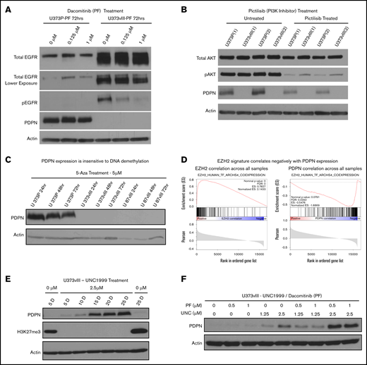 Histone methylation and oncogenic signaling impact PDPN expression. (A) Irreversible blockade of EGFR phosphorylation by dacomitinib (PF) does not rescue PDPN expression in EGFRvIII-driven U373vIII cells (n = 3). (B) Inhibition of PI3K activity (downstream effector of EGFR) by pictilisib fails to restore PDPN expression in U373vIII cells (n = 3). (C) Treatment with 5-azacytidine (5-Aza) does not lead to reexpression of PDPN protein in U373vIII cells (n = 3). (D) Relationship between known EZH2-correlated genes and EZH2 (left panel) or PDPN (right panel) across GBM cells. In each GSEA plot, the x-axis shows the ranking of genes based on their correlation with EZH2 or PDPN across the single-cell GBM data set.33 The vertical black lines denote the set of genes known to be positively correlated with EZH2, based on a meta-analysis of publicly available bulk tissue RNA-seq data sets.40 (E) Treatment of U373vIII cells with the EZH2 inhibitor (UNC1999) leads to gradual and partial reexpression of PDPN over 25 days (25 D) (n = 5). (F) Enhancement of PDPN protein expression in U373vIII glioma cells cotreated with inhibitors of EZH2 (UNC1999) and EGFR (dacomitinib) suggests a role for histone H3 trimethylation and chromatin modification, as well as EGFR kinase signaling, in PDPN regulation (n = 3)