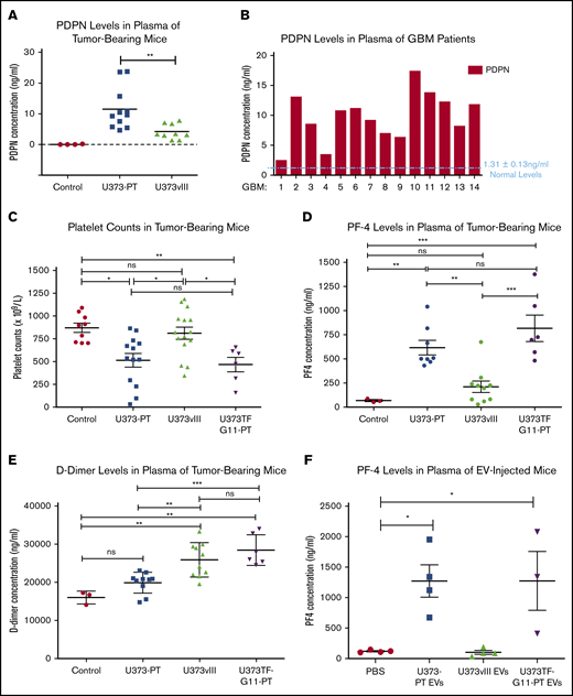 Heterogenous coagulant profiles associated with glioma. (A) Immunodetection (ELISA) of circulating human PDPN in plasma of mice with U373PT and U373vIII glioma xenografts. Suppression of PDPN in EGFRvIII-driven U373vIII cells leads to low PDPN levels in blood (Control - plasma of tumor-free mice). Tumor sizes were comparable across the entire panel (supplemental Information). (B) Detection of various PDPN levels in plasma of GBM patients (human PDPN ELISA), mostly above the normal levels of 1.31 ± 0.13 ng of PDPN protein per mL of plasma as reported in the literature.47 (C) Reduced platelet counts in mice harboring PDPNhigh glioma xenografts (U373PT, U373TF-G11-PT) vs PDPNlow tumors (U373vIII) and tumor-free controls (no myelosuppression was observed; supplemental Information). (D) Increased PF4 levels in plasma of mice with PDPNhigh glioma xenografts vs those with PDPNlow tumors and controls (as in panel C). (E) D-dimer levels in plasma of mice bearing glioma xenografts. In the case of tumors expressing PDPN (U373PT), D-dimers were not significantly different from those in controls; however, they were elevated in TF-expressing U373vIII tumors and U373TF-G11-PT tumors with high levels of TF and PDPN. (F) PF4 levels in plasma of mice injected IV with glioma EVs (10 μg per mouse). PF4 elevation occurred in mice injected with PDPN-carrying EVs (U373TF-G11-PT and U373PT) regardless of TF status, whereas PDPN− and TF+ EVs (U373vIII) did not produce any such increase above the background (phosphate-buffered saline). *P ≤ .05, **P ≤ .01, ***P ≤ .001, ANOVA multiple-comparison analysis. ns, not significant.