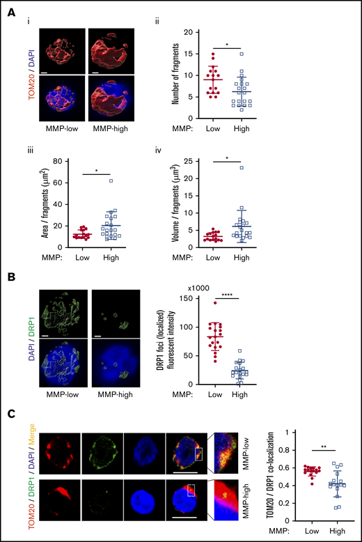 MMP-low HSCs contain more fragmented mitochondria. (Ai) Representative 3-dimensional immunofluorescent confocal images of TOM20 (red, TOM20; blue, DAPI; scale bar, 1 μm). (Aii) The total number of mitochondrial fragments per cell. (Aiii-Aiv) The average area and volume per fragment of mitochondria in each cell. (B) Representative 3-dimensional immunofluorescent confocal images (left) of DRP1 (green, DRP1; blue, DAPI; scale bar, 1 μm) and quantification (right) of fluorescence intensity of localized DRP1 foci above threshold. (C) Two-dimensional immunofluorescent confocal images (left; scale bar, 5 μm) of TOM20 (red), DRP1 (green), DAPI (blue), merged (yellow); inset contains magnified images, quantification of colocalization of TOM20 and DRP1 (right). All analyses were performed in MMP-low and MMP-high CD90+ PB HSCs. Data are presented as mean ± standard deviation; Student t test: *P < .05, **P < .01, ****P < .0001.