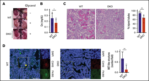 Renal damage and MET formation are reduced in DKO mice. Phenotypic analyses of RAKI WT and CLEC-2–depleted FcRγ-deficient (DKO) mice. (A) Representative macroscopic images of kidneys showing RAKI-induced ischemia. The top panel indicates water-injected (non-rhabdomyolytic) WT kidneys. (B) Serum creatinine (Cre) level at 48 hours after glycerol injection into WT and DKO mice. Data are expressed as mean ± standard deviation; n = 11 and 9, respectively. (C) Renal tubular injury evaluated by periodic acid–Schiff staining at 48 hours after glycerol injection into WT and DKO mice. Scale bars: 50 μm. Data are expressed as mean ± standard deviation; n = 7. (D) Immunofluorescence imaging of citrullinated histone H3 (CitH3, red), F4/80 (green), and 4′,6-diamidino-2-phenylindole (DAPI) (blue) for the detection of MET formation in renal tubules at 8 hours after glycerol injection into WT and DKO mice. The arrow indicates macrophages undergoing MET formation. Magnified single-color views of a framed area in each merged image are shown on the right.  Scale bars: 50 μm. Data are expressed as mean ± standard deviation; n = 6. *P < .05, **P < .01.