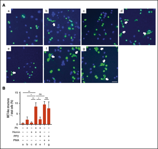 MET formation by hemin-activated platelets requires activation of the SFK pathway in platelets. (A) Macrophages differentiated from THP-1 were stimulated by resting platelets (b), hemin (c), hemin-activated platelets (d), hemin-activated platelets with PP2 (e), PMA (f), and PMA with PP2 (g). Representative images of SYTOX Green (green) and Hoechst 33342 (blue) staining are shown. Arrows indicate MET-like structures. Scale bars: 50 μm. (B) Quantification of MET-like structures. Data in the bar graph are expressed as mean ± standard error of the mean; n = 4. *P < .05, **P < .01. Holm-Šidák multiple-comparison test was used. ns, not significant.