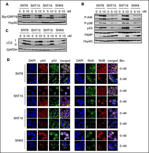 The effects of bortezomib on intracellular signaling–mediating molecules in EBV+T- or NK-cell lines. (A-C) SNT8, SNT15, SNT16, and SNK6 cells were treated with bortezomib for 24 hours and subjected to immune blotting. Hsp90 or glyceraldehyde-3-phosphate dehydrogenase (GAPDH) served as a loading control. (D) SNT8, SNT15, SNT16, and SNK6 cells were treated with bortezomib for 24 hours. The expression and the localization of NF-κB proteins were examined by immune-fluorescent staining with anti-p50, p52, RelA, and RelB antibodies. DAPI was for nuclei; original magnification ×60. The cells were analyzed by confocal microscopy.
