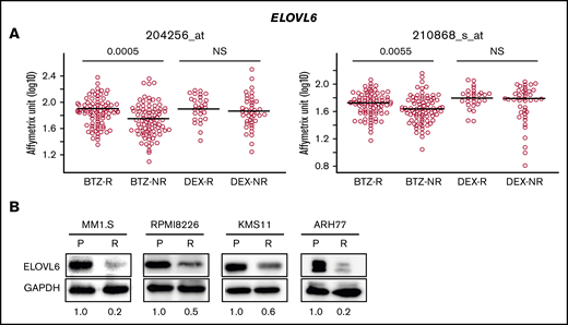 Expression of ELOVL6 correlates with response to BTZ in MM patients and resistance to BTZ in cultured MM cells. (A) Expression of ELOVL6 in patient MM cells was determined using the GSE9782 data set between patients responsive (R) or nonresponsive (NR) to BTZ (R, n = 85; NR, n = 78) or dexamethasone (DEX) (R, n = 28; NR, n = 39). Probes for ELOVL6 were extracted based on the annotation from Affymetrix (shown above the plots). The 2-tailed Wilcoxon/Mann-Whitney test was used to determine statistical significance. P values between R and NR are shown above each therapy group. (B) Parental and BTZ-resistant MM cell lines with the following BTZ 50% inhibitory concentrations were used: MM.1S-P, 6 nM; MM.1S-R, 10 nM; RPMI8226-P, 3 nM; RPMI8226-R, 15 nM; KMS11-P, 6 nM; KMS11-R, 20 nM; ARH77-P, 8 nM; and ARH77-R, 25 nM. BTZ-resistant cells were collected 3 weeks after selection. Total cell extracts of logarithmically growing parental (P) and BTZ-resistant (R) cells were probed in immunoblotting with designated antibodies. ELOVL6-specific signals were normalized by glyceraldehyde-3-phosphate dehydrogenase (GAPDH)–specific signals and by ratio of these signals in corresponding parental cells. Shown immunoblots are representative images of at least 2 independent experiments. NS, nonsignificant.