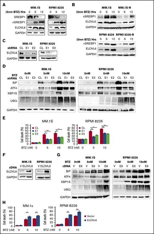 ELOVL6 regulates resistance to BTZ in MM cells. (A-B) MM cells were treated or not with BTZ for the indicated time periods followed by immunoblotting with the indicated antibodies. (C) MM cells were transduced with control (CL) or ELOVL6 shRNAs (E1 or E2) followed by immunoblotting with the indicated antibodies 48 hours postinfection. (D) Cells described in panel C were treated for 16 hours with the indicated amounts of BTZ and probed in immunoblotting with the indicated antibodies (before the onset of cell death). (E) Cells described in panel C were treated with the indicated amounts of BTZ for 24 hours and probed in trypan blue cell viability assay. (F) MM cells were transduced with empty lentiviral vector (V) or lentiviral vector expressing ELOVL6 cDNA (ELOVL6) followed by immunoblotting with indicated antibodies 48 hours postinfection. (G) Cells described in panel F were treated for 16 hours with the indicated amounts of BTZ and probed in immunoblotting with the indicated antibodies (before the onset of cell death). (H) Cells described in panel F were treated for 24 hours with indicated amounts of BTZ and probed in trypan blue cell viability assay. Shown immunoblots are representative images of at least 2 independent experiments with no tangible experimental variability. The viability data are presented as the mean values of triplicates ± standard errors of the mean. P values were determined by Student t test. *P < .05, **P < .01.