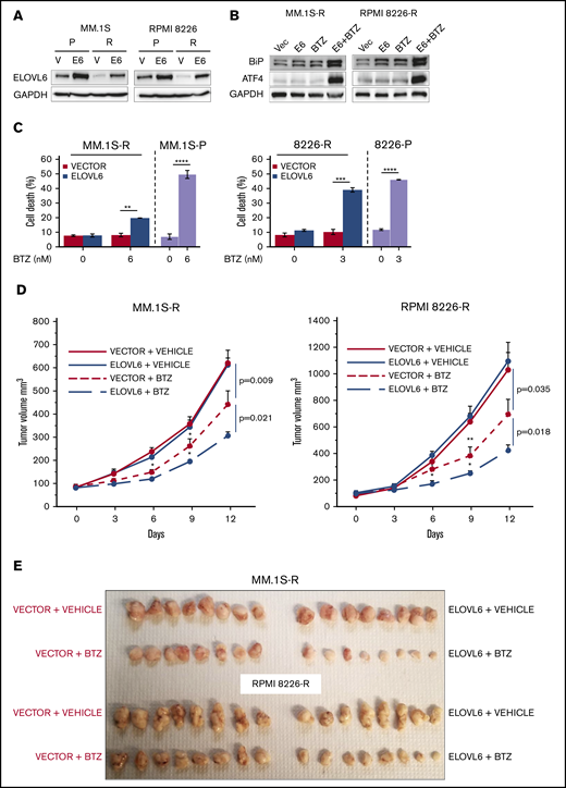 Restoration of ELOVL6 levels in BTZ-resistant cells sensitizes them to bortezomib. (A) Parental (P) and BTZ-resistant (R) MM cells were transduced with empty vector (V) or ELOVL6 cDNA-expressing vector (E6) followed by immunoblotting with indicated antibodies 48 hours postinfection. (B) BTZ-resistant MM.1S and RPMI8226 cells described in panel A were treated or not with 6 nM BTZ or 3 nM BTZ, respectively, for 16 hours followed by immunoblotting with the indicated antibodies. (C) MM cells described in panel A were treated or not with the indicated amounts of BTZ for 24 hours and probed in trypan blue cell viability assay. Shown immunoblots are representative images of at least 2 independent experiments with no tangible experimental variability. Viability data of parental MM.1S and RPMI8226 cells treated under the same conditions as BTZ-resistant cells are shown for comparison. The viability data are presented as the mean values of triplicates ± standard errors of the mean. (D) BTZ-resistant MM.1S or RPMI8226 cells transduced with empty vector or ELOVL6 cDNA-expressing vector (as in panel A) and inoculated subcutaneously into both flanks of 4- to 6-week-old female NOG mice. Mice with similar tumor burden were randomized into 2 groups (n = 5 animals per group) and treated on days 0, 3, 6, and 9 via intraperitoneal injections with vehicle (PBS) or BTZ in vehicle (0.5 mg/kg). Tumor volumes were recorded on the indicated dates. (E) At the end of the experiments, mice were euthanized, and tumors were excised, fixed in formaldehyde solution, and photographed. Data are presented as the mean values ± standard errors of the mean. P values were determined by Student t test. *P < .05, **P < .01, ***P < .001, ****P < .0001.