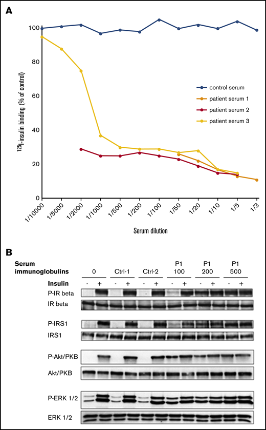 Effects of P1 serum on insulin binding and signaling. (A) Effect of patient 1 serum on 125I-insulin binding to IR. Results from 3 independent experiments. (B) Effect of P1’s serum immunoglobulins (100, 200, and 500 μg/mL as indicated) on insulin signaling. Immunoglobulins from 2 control subjects were used at 200 μg/mL for comparison. Activated (phosphorylated) and total forms of the IR β, the insulin receptor substrate-1 (IRS1), the MAP-kinase ERK1/2, and the protein kinase B (Akt-PKB) are evaluated by western blot on lysates from cells incubated or not with insulin, as indicated (see supplemental Methods). Data are representative of 2 independent experiments.