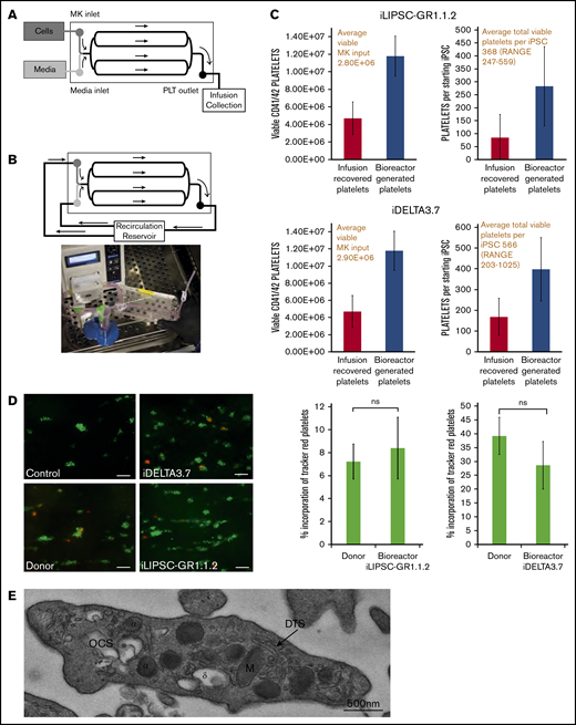 In vitro platelet production using a bioreactor. (A) Schematic of a bioreactor (Platelet BioGenesis) set up during the MK-seeding step. (B) Schematic of the bioreactor set up during the recirculation (PLP production) step, and photograph of setup. (C) Bar graphs for n = 3 runs of the bioreactor for iLIPSC-GR1.1.2 (top) and iDELTA-3.7 n = 3 runs (below) showing the final viable platelet output (left). The number of viable MKs input are shown in red above and the number of viable platelets produced per starting iPSC (right) with the total per iPSC in red above. Red bars are infusion recovered platelets and blue bars bioreactor generated. (D) In vitro thrombus formation under flow. Left panel: representative images from control, donor blood, iDELTA-3.7, and iLIPSC-GR1.1.2 bioreactor-generated platelets. In vitro–derived or donor platelets (red) human donor platelets (green). Scale bars, 20 μm. Right panel: the percentage incorporation of Cell Tracker Red–stained platelets for n = 3 replicates (3 × 80 images per chip scored) for iLIPSC-GR1.1.2 (left) and iDELTA-3.7 (right). For both lines, the incorporation of donor platelets and bioreactor platelets in thrombi are not significantly different from each other. (E) Transmission electron microscopy of a bioreactor-generated platelet. Cross-section of a bioreactor-generated platelet from LIPSC-GR1.1 containing both α (α) and δ (δ) granules, open canicular system (OCS), dense tubular system (DTS), and mitochondria (M). Scale bar, 500 nm; original magnification ×5000.