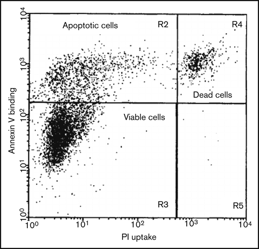 Two-dimensional flow cytometric analysis of a cell culture induced to undergo apoptosis, using annexin V affinity labeling of PS and PI uptake for DNA staining, allowing the distinction of viable, apoptotic, and dead cells. Viable cells show neither PI nor annexin V staining, whereas apoptotic cells are exclusively stained by annexin V. Necrotic (dead) cells and cells damaged during the isolation procedure become positive for both annexin V and PI. Reproduced from van Engeland et al43 with permission.