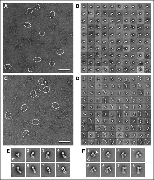 Negative-stain EM characterization of the αIIbβ3 ectodomain in complex with PT25-2 Fab. (A) Raw image of negatively stained αIIbβ3 ectodomain. Some integrins in the fully bent-closed conformation are indicated by dashed circles, whereas some integrins in more extended conformations are indicated by ovals. (B) Selected 2D class averages of negatively stained αIIbβ3 ectodomain by itself. Average 1 represents the fully bent-closed conformation. The diagram in panel E illustrates the ∼45° angle between the head and leg domains. Averages 2 to 5 show increasingly extended closed conformations. Average 6 shows a side view, and averages 7 and 8 show face-on views of the fully extended-closed conformation. (C) Raw image of negatively stained αIIbβ3 ectodomain in complex with PT25-2 Fab. Some integrins with a bound Fab are indicated by ovals. (D) Selected 2D class averages of negatively stained αIIbβ3 ectodomain in complex with PT25-2 Fab. Average 1 shows the complex in the most compact conformation. The diagram in panel F illustrates the ∼80° angle between the head and leg domains, and the arrowhead points to the PT25-2 Fab that prevents a closer association of the leg domains with the headpiece. Averages 2 to 7 show increasingly extended closed conformations of the PT25-2 Fab-bound αIIbβ3 ectodomain. Average 8 shows a side view of the fully extended-closed conformation. The scale bars in panels A and C are 50 nm, and the side length of the individual class averages in panels B and D is 43.2 nm.