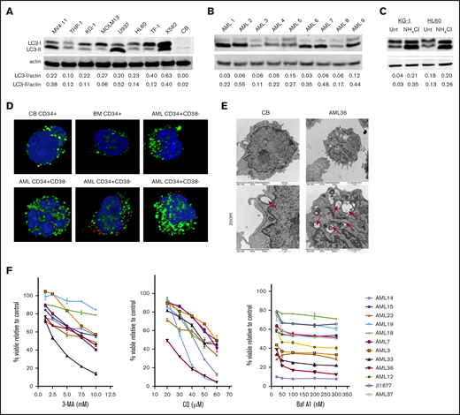 AML cells have high levels of constitutive autophagy, compared with normal CD34+cells and are sensitive to autophagy inhibition. Immunoblot analysis of the indicated AML cell lines (A) and patient samples (B) of LC3 and actin (loading control) showed different levels of basal autophagy. Quantification of LC3-I and -II levels was performed with Image J software. (C) The KG-1 and HL60 cell lines were incubated with NH4Cl overnight (>12 hours), and the lysates were analyzed for LC3 and actin (loading control). Increased LC3-II after treatment indicates active autophagic flux. (D) CD34+ cells from CB, BM, or patients with AML were stained with antibodies against LC3 (green) as a marker of autophagosomes or LAMP-2 (red) as a marker of lysosomes with DAPI (blue) as a nuclear stain. (E) Electron micrograph images show more autophagosomes in AML cells, compared with nonmalignant CB cells. Original magnification ×15 000, ×30 000 zoom. (F) Samples from AML patients were treated with increasing concentrations of autophagy inhibitors CQ, 3-MA, or Baf A1. Cell viability was measured with YOPRO-1 and 7-AAD and is displayed as the percentage of viable cells, compared with the untreated controls.