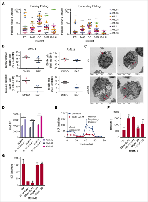 Baf A1 preferentially targets functionally defined LSCs and leads to the accumulation of damaged mitochondria. (A) Primary cells from patients with AML were grown in methylcellulose with the indicated drug (7.5 µM PTL, 2.5 µM Ara-C, 40 µM CQ, 50 nM Baf A1, and 10 mM 3-MA). Data are shown as the number of CFUs, compared with those in untreated cells. After the primary plating was quantified, the cells were collected for a secondary replating (technical replicates). Error bars represent ± standard error of the mean (SEM). Statistical analysis compared each treatment mean with that of Baf A1. (B) NSG mice were inoculated with samples from 2 patients with AML (AML 1 and AML 2) and treated with DMSO or Baf A1 (1 mg/kg) intraperitoneally 2 times per week for 4 weeks (5 mice per group). The BM was then harvested from the mouse recipients of the primary transplant, measured for AML burden by flow cytometry for human and mouse CD45, and injected via the tail vein into the second set of NSG mice. The AML burden of the secondary transplant was measured after 6 to 8 weeks. (C) Electron micrographs of healthy donor CB or AML18 samples after overnight treatment with Baf A1 (25 nM). AML cells demonstrated an increase in the number of mitochondria. Original magnification ×15 000. (D) CD34+-enriched samples from patients with AML were treated with 25 nM Baf A1 for 48 hours, then stained for mitochondria using MitoID (2 technical replicates). Data are shown as mean fluorescence intensity (MFI) of MitoID. (E-G) AML samples or MOLM-13 cells were treated with Baf A1 or CQ for 48 hours. Viability of all samples was >85%, by trypan blue exclusion. (E) Representative MitoStress Test profile determined with a Seahorse XF analyzer. (F) MitoID MFI (≥3 biological replicates; 3 technical replicates). (G) Average maximal respiration (≥3 biological replicates; 3 technical replicates). Error bars represent ± standard deviation. *P < .05; ** P < .01; *** P < .001. ns, not significant.