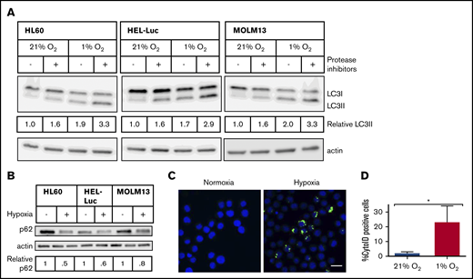 Hypoxia induces autophagic flux in AML cell lines. AML cell lines were incubated in normoxia or hypoxia for 48 hours, with or without lysosomal protease inhibitors (10 µg/mL pepstatin A and E-64d) added for the final 6 hours. (A) Immunoblot analysis of LC3 and actin (loading control) is shown. LC3-II levels were determined by densitometric analysis and normalized to actin. Values are relative to untreated cells in 21% O2. (B) Immunoblot analysis of p62 and actin (loading control). Blots are representative of 2 independent experiments. (C) HEL-Luc cells were stained with Cyto-ID, fixed, mounted in Vectashield+DAPI, and imaged on a Leica TCS SP2 spectral confocal microscope with a 63× objective (blue, nucleus/DAPI; green, autophagosomes/Cyto-ID). Bar represents 10 µm. (D) Microscopic images were quantified by ImageJ to determine the percentage of Cyto-ID+ cells (3 biological replicates, ≥100 cells counted per replicate). Error bars represent ± standard deviation. *P < .05.