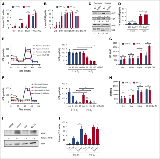 Sensitivity to autophagy inhibitors in hypoxia correlates with the extent of inhibition of mitochondrial respiration. (A-B) MOLM-13 AML cell lines were treated with the indicated concentrations of CQ (A) or Baf A1 (B) in normoxia or hypoxia for 72 hours and analyzed by annexin V/PI flow cytometry (≥3 biological replicates; 2 technical replicates). (C-D) MOLM-13 cells were transfected with siRNAs against Atg-5 and Atg-7. After 24 hours, they were placed in normoxia or hypoxia. Lysates harvested after 48 hours for immunoblot analysis (C) (quantification under each blot normalized to actin, followed by normalization to NT in normoxia), or the cells were analyzed after 72 hours by annexin V/PI flow cytometry (D) (3 biological replicates; 2 technical replicates). (E-F) MOLM-13 cells were treated with CQ (E) or Baf A1 (F) for 48 hours in normoxia or hypoxia and analyzed on a Seahorse XF analyzer. Representative MitoStress Test profiles and average maximal respiration for cells are shown (2 biological replicates; 3 technical replicates). (G-H) MOLM-13 cells were treated with CQ (G) or Baf A1 (H) for 48 hours, stained with MitoID, and analyzed by flow cytometry (3 biological replicates; 2 technical replicates). Data are shown as average mean fluorescence intensity (MFI). (I) MOLM-13 cells were harvested after a 48-hour treatment with 10 µM CCCP, 50 µM CQ, or 25 nM Baf A1 and blotted for PINK-1. The levels were determined by densitometric analysis and normalized to actin. Values are shown relative to DMSO. (J) MOLM-13 cells were treated with 10 µM CCCP or 50 µM CQ, alone or in combination in normoxia or hypoxia for 72 hours, and analyzed by annexin V/PI flow cytometry (3 biological replicates; 2 technical replicates). Error bars represent ± standard deviation. *P < .05; **P < .01; ***P < .001; ****P < .0001.