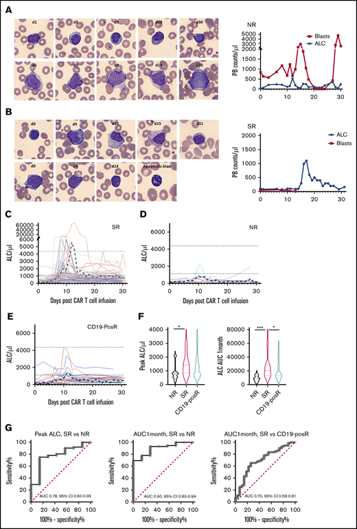 Differences in morphology and kinetics in SRs, NRs, and relapses. (A) Normal mature lymphocytes (top) and persistent blasts (bottom) in NR patient HP-9 (left). Representative CellaVision images at ×500 original magnification. ALC and blast kinetics in NR HP-9 (right). (B) Increase in atypical lymphocytes (left top, days 5-15), as blasts (left bottom) disappeared by day 13 in responder HP-83. Example of an apoptotic cell (with crenellated nucleus) after CAR-infusion is shown in a day-13 image. ALCs and blast kinetics in responder HP-83 (right). (C) Individual ALC curves and mean (black dashed line) in 72 SRs show characteristic ALC proliferation kinetics with initial lag phase, then marked expansion, followed by rapid contraction and persistence. (D) Individual ALC curves and mean in 7 NRs show decreased lymphocyte proliferation. (E) Individual ALC curves and mean in 27 (eventual) CD19-posRs. Dotted black lines indicate mean upper and lower limits of normal ALC. The y-axes are shown in linear scale, similar to ALC graphs in the electronic medical record (EPIC) and to highlight low-level peaks. (F) Violin plots depicting medians, quartile ranges, and distribution of various groups (left) show significantly (*P = .04, Kruskal-Wallis test) higher peak ALCs in SRs than in NRs, but not in SRs vs CD19-posRs (P = .1). Violin plots of ALC AUC1mo in various groups (left) showing significantly higher overall ALC expansion in SRs compared with NRs (***P = .0009) and CD19-posRs (*P = .013). (G) ROC analyses of peak ALC and ALC AUC1mo in SRs and NRs and ALC AUC1mo in SRs and CD19-posRs.