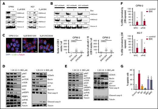 Underlying mechanisms of action of G9a/GLP targeting in MM. (A-B) Effect of G9a/GLP targeting on H3K9me1-3 levels. (A) Western blot analysis of H3K9me1, H3K9me2, and H3K9me3 levels in OPM-2 cells (left panel) and XG-7 cells (right panel) after 96 hours of treatment with or without BIX01294 (BIX; 2 µM). (B) XG-7 cells transduced with 3 shG9a constructs were cultured or not with doxycycline (Dox; 1 mg/mL) for 7 days, after which H3K9me2 and H3K9me3 levels were analyzed by western blot. Histone 3 was used as loading control; 1 experiment representative of 3 experiments is shown. Quantification and normalization were performed with ImageJ, and quantification relative to the control condition is shown. (C) Effect of G9a/GLP targeting on autophagy. Immunofluorescence staining for DAPI, LC3B, and α-tubulin on OPM-2 and XG-20 cells, treated or not with 5 µM BIX01294 or UNC0638 for 24 hours. Scale bars, 10 µm. Photographs shown are representative of 1 experiment; quantification data are based on 3 independent experiments. ****P < .001. (D-E) Western blot analysis of involved signaling pathways and downstream targets. OPM-2 cells (D) and XG-7 cells (E) were treated with 1.25 µM, 2.5 µM, or 5 µM BIX01294 for 24 hours, after which whole-cell lysates were analyzed for the indicated proteins. Tubulin was used as loading control; 1 experiment representative of 3 experiments is shown. (F) mRNA expression levels of MYC and eIF4E in OPM-2 cells (upper panel) and XG-7 cells (lower panel) treated or not with 5 µM BIX01294 (BIX) for 24 hours. Data are mean ± standard deviation (SD) of 3 independent experiments. *P < .05. (G) Effect of the autophagy inhibitor 3-ME on BIX01294 (BIX)-induced cell death. OPM-2 cells were treated for 4 hours with 3-ME (1 and 2 mM), after which BIX (2.5 µM) was added for an additional 48 hours. The effect on apoptosis was assessed using Annexin V-APC/7-aminoactinomycin D (7-AAD), followed by flow cytometric analysis. The percentage of apoptotic cells is the sum of the percentage of Annexin V+ and Annexin V+/7-AAD + cells. Data are mean ± SD of 3 independent experiments. *P < .05 vs Bix alone.