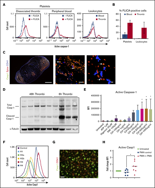Active caspase-1 is present in both thrombi and blood cells in murine DVT and can be induced by histones and NETotic neutrophils in human platelets. (A) FLICA incorporation (active caspase-1) in platelets (from thrombi and blood) and leukocytes 48 hours after IVC stenosis. (B) Quantification of FLICA-positive platelets and leukocytes in both thrombi and blood (n = 5, mean ± standard deviation). (C) Immunofluorescence staining of thrombi sections for FLICA (green), SYTOX Orange (red), and CD41 (blue). Arrows indicate areas of colocalization of FLICA and SYTOX Orange. Scale bars: left = 100 μm, middle = 50 μm, right = 10 μm. (D) Total and cleaved (activated) caspase-1 content in thrombus lysates at either 48 or 6 hours after IVC stenosis (representative gel, n = 4-5). (E) MFI for FLICA incorporation (caspase-1 activation) by washed human platelets stimulated with ATP, nigericin, PAF, and calf histones, at indicated concentrations, or left untreated (n = 3, mean ± standard deviation). One-way analysis of variance, Dunnett’s multiple comparison test, *P ≤ .05. (F) Representative plot of FLICA incorporation by human platelets treated with individual human histones and evaluated by flow cytometry. (G) Immunofluorescent staining of histone-stimulated platelets with FLICA (green) and CD41 (red). Scale bar = 10 µm, n = 3. (H) MFI quantification for FLICA from autologous platelets seeded on NETotic neutrophils after treatment with PMA for 2 hours (n = 3 biological replicates, data points indicate technical replicates). One-way analysis of variance, Tukey’s multiple comparison test, *P ≤ .05.