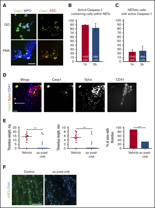 NETs and active caspase-1 colocalize both in vitro and in vivo, and inhibition of caspase-1 reduces DVT. (A) Immunofluorescent staining for activated caspase-1 on NETs formed by human neutrophils stimulated with either PMA or glucose oxidase (FLICA, green; ASC, red; myeloperoxidase, blue). Scale bar = 15 μm. Quantification of the percentage of active caspase-1–containing cells that simultaneously release NETs (B) and the percentage of NETotic cells containing active caspase-1 (C) (n = 3). (D) Z-projection of the murine IVC wall 2 hours after stenosis obtained by intravital microscopy (FLICA/active caspase-1, green; SYTOX Orange, red; CD41, blue). Asterisk depicts the site of stenosis; arrow shows the direction of blood flow. Scale bar = 100 μm, n = 3. (E) Thrombus weight and length, and thrombosis incidence in ac-yvad-cmk (n = 12) and vehicle control-treated mice (n = 12). **P ≤ .01; weight and length, Mann-Whitney U test; incidence, Fisher’s exact test. (F) Citrullinated histone 3 (green) and DNA (blue) immunofluorescence staining of control thrombi and of thrombi developed in mice treated with ac-yvad-cmk. Scale bar = 25 μm, n = 4.