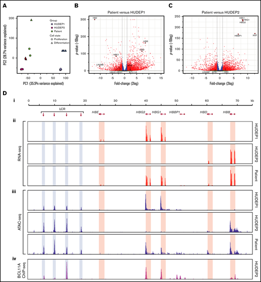 RNA expression and chromatin accessibility at the HBB locus. (A) Principal component analysis of RNA-seq data. PC1 separates fetal cells (HUDEP1) from adult cells (HUDEP2 and patient). PC2 separates cells according to differentiation status. (B) Volcano plot of HUDEP1 cells vs patient RNA-seq data. (C) Volcano plot of HUDEP2 cells vs RNA-seq data. (D) An overview of the HBB locus (Di) with RNA expression (RNA-seq; red) (Dii) and chromatin accessibility (ATAC-seq; blue) (Diii) assays on HUDEP1 and HUDEP2 cells and patient HEPs. (Div) Binding of BCL11A to the HBB locus in HUDEP2 cells, as assessed by chromatin immunoprecipitation followed by NGS (ChIP-seq); data are from Martyn et al.64HBB, β-globin gene; HBBP1, β-globin pseudogene 1; HBD, δ-globin gene; HBE, ε-globin gene; HBG1, Aγ-globin gene; HBG2, Gγ-globin gene; LCR, a series of enhancers marked by hypersensitive sites.