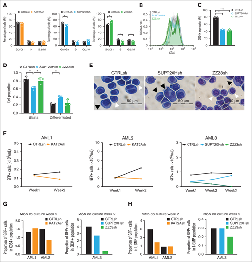 KAT2A complex activity maintains propagation of undifferentiated cultured and primary CD34+AML cells. (A) Quantification of flow cytometry analysis of cell cycle in Kasumi-1 cells transduced with KAT2Ash, SUPT20Hsh, and ZZZ3sh. Mean ± SEM of 3 independent experiments. Two-tailed Student t test for significance *P < .05. (B) Representative flow cytometry overlay plot of analysis of undifferentiated marker CD34 in KG1a cells transduced with CTRLsh, SUPT20Hsh, and ZZZ3sh. (C) Quantification of CD34+cells in transduced KG1a cells in panel B. N = 3 independent experiments. Two-tailed Student t test for significance **P < .01. (D) Quantification of blast-like and differentiated cells in KG1a cultures transduced with CTRLsh, SUPT20Hsh, and ZZZ3sh. Scoring of 3 randomly selected fields of >100 cells; Two-tailed Student t test for significance; *P < .05. (E) Representative photographs of KG1a cytospins. White arrow heads denote blast-like cells; black arrow heads denote differentiated cells. Bar represents 50 μm. (F) Growth of human primary AML cells (CD34+samples; details in supplemental File 5) transduced with CTRLsh, KAT2Ash, SUPT20Hsh, or ZZZ3sh and maintained in the MS5 coculture system for 2-3 weeks. (G) Percentage of GFP+ CD34+ cells in AML samples in panel F analyzed at week 2 of the MS5 coculture. Analysis gates are presented in supplemental Figure 6A. Data are normalized to global GFP level to correct for unequal GFP transduction levels. (H) Percentage of GFP+ GMP-like (L-GMP) cells at week 2 of the MS5 coculture system in AML samples in panel F. Analysis gates in supplemental Figure 7A. GFP transduction correction as in panel G.