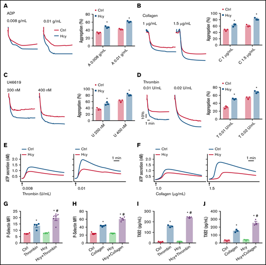 Hcy amplifies platelet aggregation and degranulation in vitro. Washed platelets harvested from C57BL/6J mice were incubated with or without Hcy (100 μM) for 10 minutes and then stimulated with the indicated concentrations of ADP (A), collagen (B), U46619 (C), and thrombin (D) at 37°C, with constant stirring (1200 rpm). Then, platelet aggregation was monitored with a turbidimetric aggregometer. (E-F) ATP secretion was measured in the presence of luciferin/luciferase reagent. The traces in the figures are representative of at least 3 independent experiments. (G-H) Flow cytometric analysis of P-selectin exposure in platelets with or without Hcy stimulation in the presence of thrombin (0.01 U/mL) (G) or collagen (1.5 μg/mL) (H). MFI, mean fluorescence intensity. (I-J) TXB2 production in control and Hcy-treated platelets stimulated with thrombin (0.01 U/mL) (I) or collagen (1.5 μg/mL) (J) was analyzed by enzyme-linked immunosorbent assay. All data are expressed as the mean ± SEM (n = 3-5). *P < .05 compared with ctrl; #P < .05 compared with thrombin or collagen.