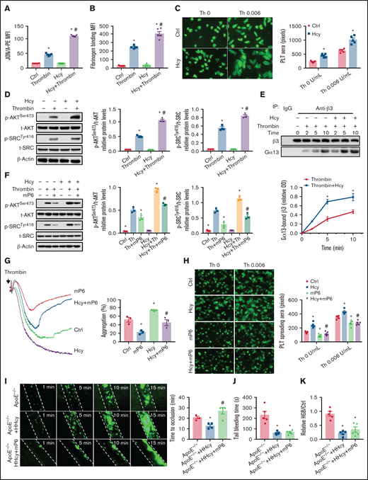 A high-affinity state of integrin αIIbβ3 mediates HHcy-induced platelet activation and thrombosis in mice. (A) Flow cytometric analysis of PE-JON/A binding to control and Hcy-incubated platelets from C57BL/6J mice stimulated with thrombin (0.01 U/mL). (B) Flow cytometric analysis of fluorescein isothiocyanate-labeled fibrinogen binding to control and Hcy-incubated platelets from C57BL/6J mice stimulated with thrombin (0.01 U/mL). MFI, mean fluorescence intensity. (C) Washed platelets from C57BL/6J mice were allowed to adhere and spread on fibrinogen-coated wells in the presence of 100 μM Hcy or vehicle, with or without thrombin (Th), at 37°C for 2 hours. Representative images (left, stained with phalloidin, original magnification, 400×); surface areas of single platelets (right). (D) Western blot analysis of p-AKTSer473 and p-SRCTyr416 protein expression and quantification. β-Actin was used as an internal control. (E) Washed platelets from C57BL/6J mice were solubilized at the indicated time points and the amount of β3 that coimmunoprecipitated with Gα13 was analyzed by western blot (n = 3-5). *P < .05 compared with ctrl; #P < .05 compared with thrombin. (F) p-AKTSer473 and p-SRCTyr416 protein levels in platelets with or without Hcy stimulation and treatment with 10 μM mP6 for 10 minutes with thrombin (0.01 U/mL) were analyzed by western blot (n = 3). *P < .05 compared with agonists; #P < .05 compared with HHcy+agonists. OD, optical density. (G) Platelet aggregation with 10 μM mP6 or control peptide in the presence/absence of Hcy was monitored with a turbidimetric aggregometer. (H) Washed platelets from C57BL/6J mice were allowed to adhere and spread on fibrinogen-coated wells with 100 μM Hcy in the presence of mP6 (20 μM). The spreading area of individual platelets (stainted with phalloidin, original magnification, 200×) was measured with ImageJ software (n = 3-5). *P < .05 compared with ctrl; #P < .05 compared with Hcy. (I-K) ApoE−/− mice were intraperitoneally injected with 100 mg/kg Hcy or vehicle (saline), and after 2 hours, the mice were treated with mP6 liposomes (10 μmol/kg) or vehicle (control peptide liposomes). (I) Platelets were labeled with calcein-AM. Representative images of FeCl3-induced mesenteric arteriole thrombosis (left, original magnification, 200×, the dotted line indicates the arterial vessel wall). Occlusion time of the mesenteric arteriole (right). Tail-bleeding time was determined (J), and blood loss was assessed (K). HGB, hemoglobin. All data are expressed as the mean ± SEM (n = 5). *P < .05 compared with ApoE−/−; #P < .05 compared with ApoE−/−+HHcy. PLT, platelets.