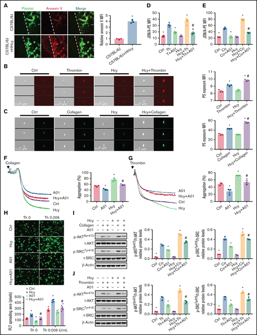 PS exposure mediates platelet integrin αIIbβ3 activation in response to Hcy stimulation. (A) Calcein-AM–labeled platelets and iFluor 555-annexin V antibodies were injected into C57BL/6J mice with or without Hcy (100 mg/kg) injection (left). Representative images of FeCl3-induced mesenteric arteriole thrombosis (green indicates platelets, red indicates annexin V right, the dotted line indicates the arterial vessel wall, original magnification, 400×). The relative quantitation for PS exposure (HHcy-MFI/control-MFI) in vivo. (B-C) Washed platelets from C57BL/6J mice were incubated with or without Hcy (100 μM) for 20 minutes and then stimulated with thrombin (0.01 U/mL) or collagen (1.5 μg/mL) at 37°C for 30 minutes. Representative immunofluorescence staining (left) and quantitation (right) of PS exposure were analyzed by image-capture flow cytometry. All data are expressed as the mean ± SEM (n = 3). *P < .05 compared with ctrl; #P < .05 compared with thrombin or collagen. (D-E) JON/A binding after 20 μM A01 or vehicle (DMSO, no greater than 0.1%) treatment of 10 minutes, followed by stimulation with (D) thrombin (Th, 0.01 U/mL) or collagen (Co, 1.5 μg/mL) (E) in the presence/absence of Hcy (100 μM) was assessed by flow cytometry. All data are expressed as the mean ± SEM (n = 5). *P < .05 compared with agonists; #P < .05 compared with Hcy+agonists. (F-G) Platelets from C57BL/6J mice were aggregated after stimulation with 20 μM A01 or vehicle, followed by collagen (1.5 μg/mL) (F) or thrombin (0.01 U/mL) (G) stimulation in the presence/absence of Hcy on a turbidimetric aggregometer. (H) Washed platelets from C57BL/6J mice were allowed to adhere and spread on fibrinogen-coated wells in the presence of 100 μM Hcy or vehicle with A01 (20 μM). The spreading area of individual platelets (stainted with phalloidin, original magnification, 200×) was measured using ImageJ software. All data are expressed as the mean ± SEM (n = 5). *P < .05 compared with ctrl; #P < .05 compared with Hcy. (I-J) p-AKTSer473 and p-SRCTyr416 protein levels in platelets, with or without Hcy, were analyzed after treatment with 20 μM A01 for 10 minutes with collagen (1.5 μg/mL) (I) or thrombin (0.01 U/mL) (J) by western blot analysis. All data are expressed as the mean ± SEM (n = 3-5). *P < .05 compared with agonists; #P < .05 compared with Hcy+agonists. MFI, mean fluorescence intensity.