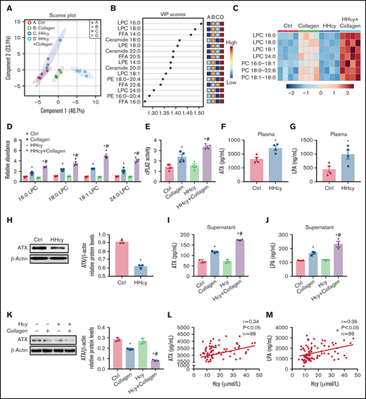 HHcy activates phospholipid hydrolysis of platelet membrane and ATX secretion. (A-E) HPLC-MS/MS analysis of lipid metabolites in platelets from C57BL/6J mice that were intraperitoneally injected with 100 mg/kg Hcy or vehicle (saline) for 2 hours. (A) Principal component analysis (PCA) scatterplot of lipid metabolites in platelets. (B) VIP scatterplot identified by PCA showing the top 15 lipid metabolites in the different groups. (C) Heat map illustrating the phospholipid metabolic profiles in platelets. (D) HPLC-MS/MS analysis of different levels of LPC species in platelets. (E) cPLA2 activity of platelets from acute HHcy and control mice in vivo. (F-H) C57BL/6J mice were intraperitoneally injected with 100 mg/kg Hcy or vehicle (saline) for 2 hours. Plasma ATX (F) and LPA (G) levels were measured via enzyme-linked immunosorbent assay (ELISA; Cloud-Clone Corp). (H) Western blot analysis of ATX expression in platelets. β-Actin was used as an internal control. (I-K) Washed platelets from C57BL/6J were incubated with 100 μM Hcy for 10 minutes, then stimulated with 1.5 μg/mL collagen. The levels of ATX (I) and LPA (J) in platelet-activated supernatant were measured by ELISA. ATX protein expression (K) in platelets was analyzed by western blot, with β-actin used as the internal control. All data are expressed as the mean ± SEM (n = 3-4). *P < .05 compared with ctrl; #P < .05 compared with collagen. (L-M) Correlations between human plasma Hcy concentrations and the levels of ATX (L) and LPA (M) were measured by ELISA (n = 88).