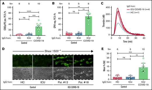 ICU COVID-19 IgGs induce procoagulant PLTs, GPVI cleavage, increased thrombin generation and thrombus formation on collagen. (A) HC, ICU non-COVID-19, and ICU COVID-19 IgG-induced changes in wPLTs externalization of PS and expression of CD62p were analyzed via annexin V-FITC and CD62p-APC antibody staining, respectively. Data are shown as mean percentage ± SEM of annexin V-FITC and or CD62p-APC-positive-labeled wPLTs. (B) ICU-COVID-19 IgG-induced reductions in the expression of GPVI on the PLT surface were analyzed by GPVI-PE antibody staining and compared as percentage of GPVI-negative PLTs ± SEM to the controls. (C) PRP from healthy individuals was preincubated with HC or ICU COVID-19 IgG and analyzed for thrombin generation using CAT. Each curve represents the amounts of generated thrombin over time induced by HC (dotted blue line) or IgG from different ICU COVID-19 patients (red line) (D) PRP from healthy individuals with the blood group O was incubated with HC, ICU non-COVID-19 control, or ICU COVID-19 IgG, labeled with FITC conjugated calcein and perfused through microfluidic channels at a shear rate of 1500−1 (60 dyne) for 5 minutes after reconstitution into autologous whole blood. Images were acquired at x20 magnification in the fluorescent (upper panel) as well as in the BF channel (lower panel). Scale bar 50 µm. (E) Mean percentage of surface are covered (SAC) by thrombus ± SEM in the presence of HC, ICU non-COVID-19 control, and ICU COVID-19 IgG after 5 minutes perfusion time. The number of patients and healthy donors tested is reported in each graph. See Figure 1 for P values and abbreviation definitions.