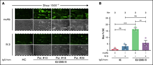 FcγRIIA inhibition prevents ICU COVID-19 IgG-induced thrombus formation. (A) PRP from healthy individuals with the blood group O was incubated with HC or ICU COVID-19 IgG in the presence of moAb IV.3 or isotype control (moAb) and perfused through microfluidic channels at a shear rate of 1500−1 (60 dyne) for 5 minutes. Images were acquired at x20 magnification in fluorescent (upper panel) as well as in the BF channel (lower panel). Scale bar 50 µm. (B) Mean percent of SAC ± SEM induced by HC or ICU COVID-19 IgG in the presence or absence of moAb IV.3 or isotype control (moAb). The number of patients and healthy donors tested is reported in each graph. See Figure 1 for P values and abbreviation definitions.