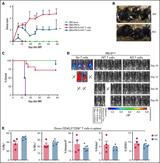 MiR-31 is dispensable in T cell–mediated GVL response. (A-E) WT or miR-31 KO T cells (2.75 × 106; CD45.2+) plus WT T cell–depleted BM (CD45.1+) were transferred into lethally irradiated B6D2F1 mice. On the day of BMT, 5000 luciferase-transduced P815 cells were IV injected into these recipients. Clinical scores (A), macroscopic photos of recipients on day 40 (B), and survival (C) are shown. P815 growth was monitored by bioluminescence imaging (D). Frequencies of IFN-γ+, tumor necrosis factor α–positive (TNFα+), granzyme B+, perforin+, and CD107a+ cells in gated live H2Kd-CD45.2+CD8+ cells (E) are shown in recipient spleens on day 50 post-BMT. Data shown are from 1 representative of 2 individual experiments (n = 4-5 mice per group for each experiment). **P < .01.
