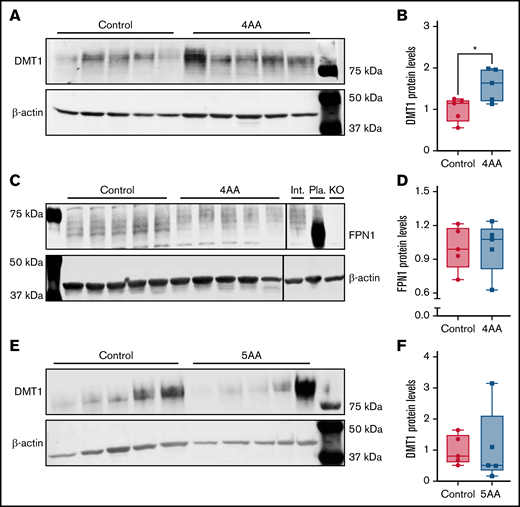 The 4 AA formulation specifically targets DMT1. Eight-week-old male mice (n = 10) were fed a low-iron diet for 10 days. Subsequently, mice were fasted for 2 hours and then administered an electrolyte buffer with or without the 4 AAs by oral, intragastric gavage. One hour later, mice were killed, and BBMVs were isolated from duodenal scrapes for DMT1 western blots (A). DMT1 protein levels were higher in the 4 AA group (*P < .05; unpaired t test) (B). Another group of 10 mice was treated identically, and duodenal scrapes were used to isolate total membrane proteins for FPN1 western blots (C). FPN1 expression was unaffected by the 4 AAs (unpaired t test) (D). To demonstrate specificity, another group of iron-deprived mice (n = 5) was also treated with a formulation made up of 5 AAs that did not increase DMT1 protein expression in loop studies (or buffer only; n = 5). Outcomes showed that the 5 AAs did not increase DMT1 protein levels in BBMVs (unpaired t test) (E-F).